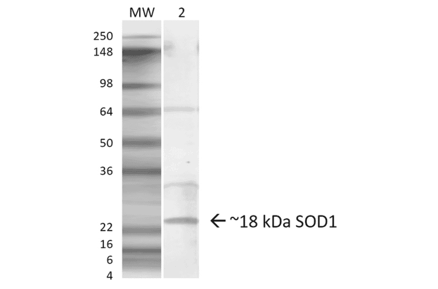 Western Blot - Anti-Superoxide Dismutase 1 Antibody (A305127) - Antibodies.com