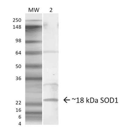 Western Blot - Anti-Superoxide Dismutase 1 Antibody (A305127) - Antibodies.com