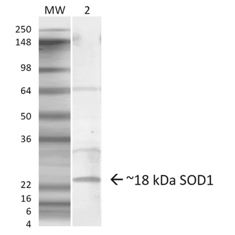 Western Blot - Anti-Superoxide Dismutase 1 Antibody (A305127) - Antibodies.com