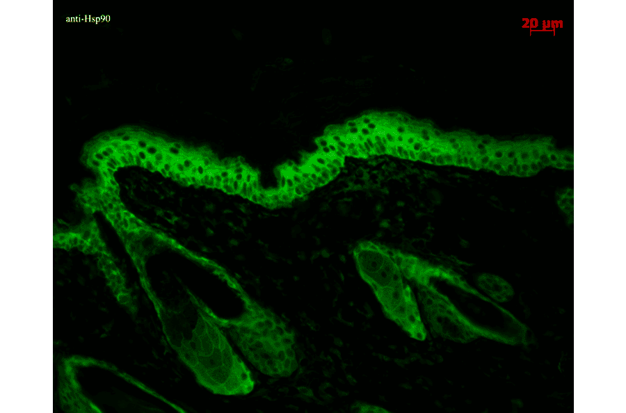 Immunohistochemistry - Anti-HSP90 beta Antibody [H9010] (A305130) - Antibodies.com