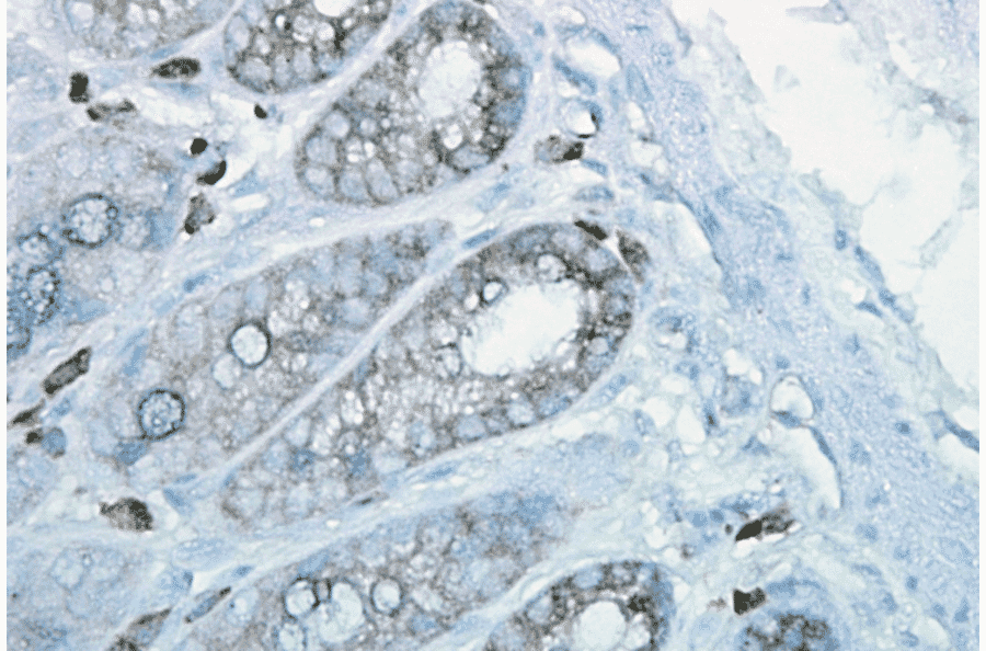 Immunohistochemistry - Anti-HSP90 beta Antibody [H9010] (A305130) - Antibodies.com