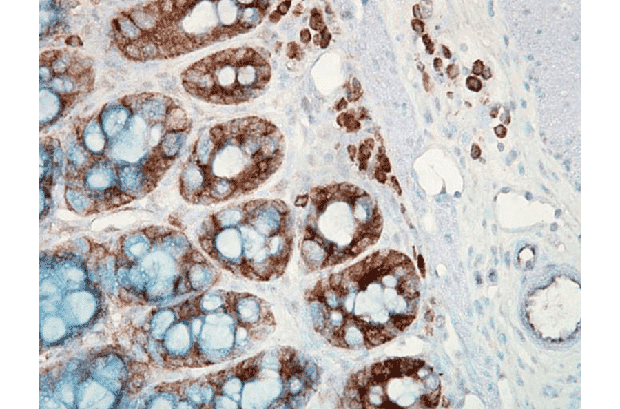 Immunohistochemistry - Anti-HSP90 beta Antibody [H9010] (A305130) - Antibodies.com