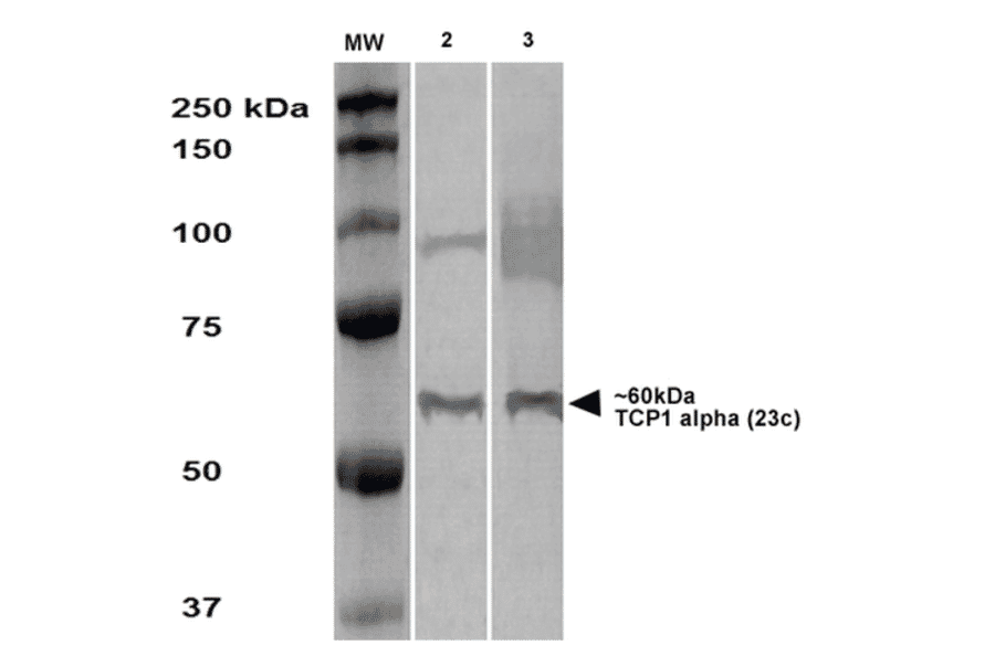 Western Blot - Anti-TCP1 alpha / CCTA Antibody [23c] (A305132) - Antibodies.com