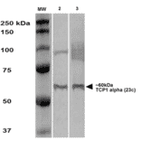 Western Blot - Anti-TCP1 alpha / CCTA Antibody [23c] (A305132) - Antibodies.com