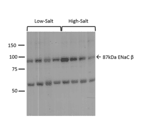 Western Blot - Anti-SCNN1B Antibody (A305133) - Antibodies.com