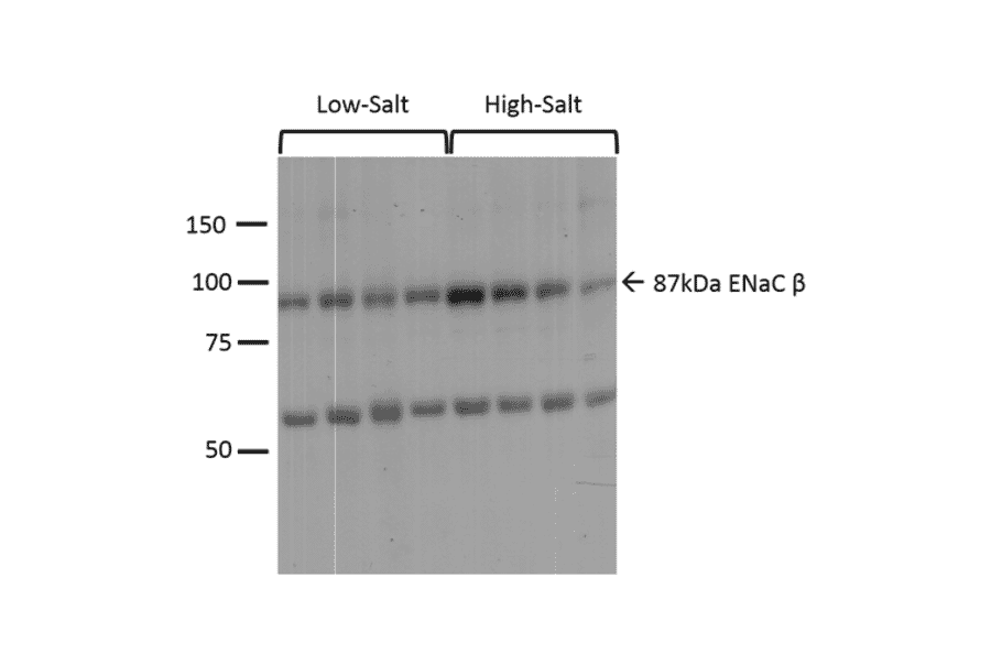 Western Blot - Anti-SCNN1B Antibody (A305133) - Antibodies.com