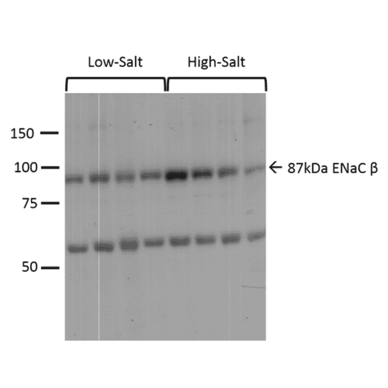 Western Blot - Anti-SCNN1B Antibody (A305133) - Antibodies.com