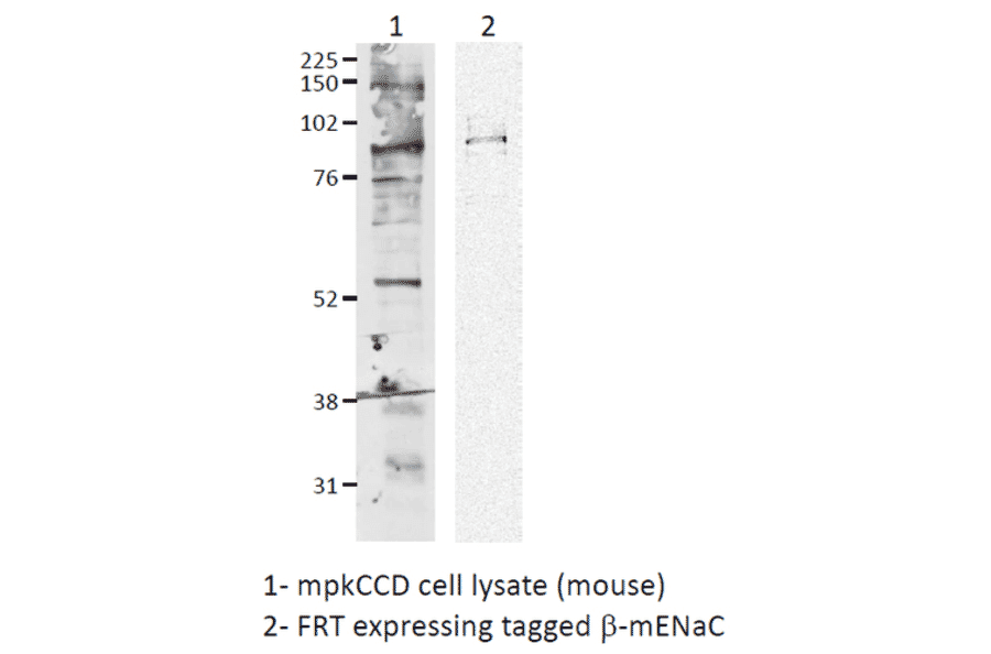 Western Blot - Anti-SCNN1B Antibody (A305133) - Antibodies.com
