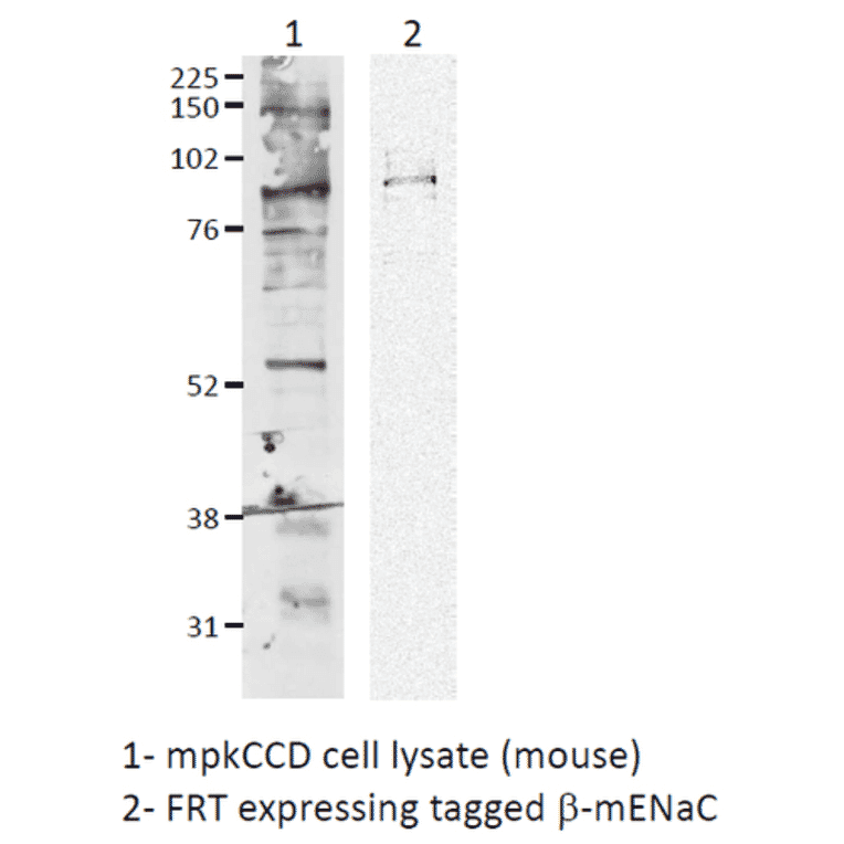 Western Blot - Anti-SCNN1B Antibody (A305133) - Antibodies.com