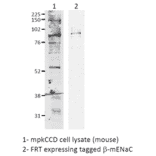 Western Blot - Anti-SCNN1B Antibody (A305133) - Antibodies.com