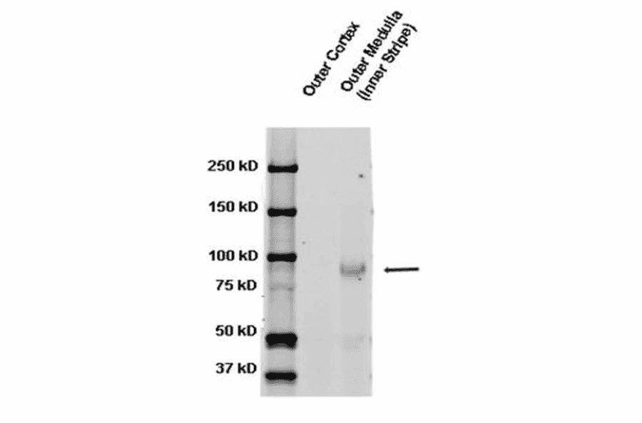 Western Blot - Anti-SCNN1B Antibody (A305133) - Antibodies.com