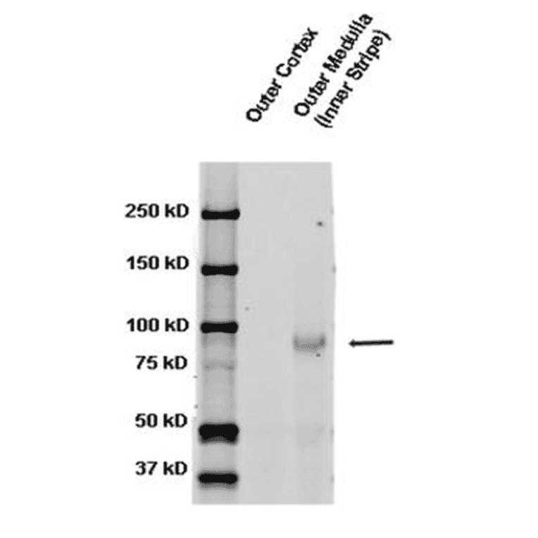 Western Blot - Anti-SCNN1B Antibody (A305133) - Antibodies.com