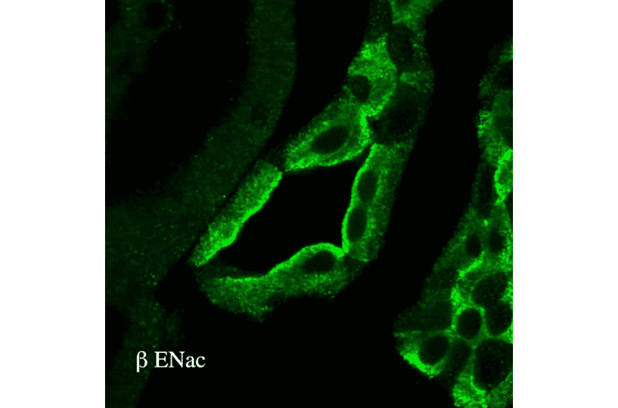Immunohistochemistry - Anti-SCNN1B Antibody (A305133) - Antibodies.com