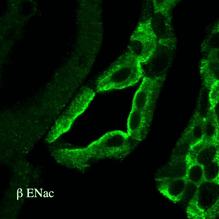 Immunohistochemistry - Anti-SCNN1B Antibody (A305133) - Antibodies.com