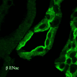 Immunohistochemistry - Anti-SCNN1B Antibody (A305133) - Antibodies.com