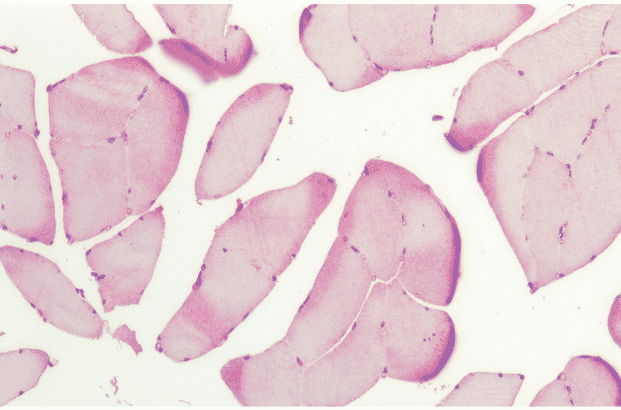 Immunohistochemistry - Anti-HSP27 Antibody (A305135) - Antibodies.com