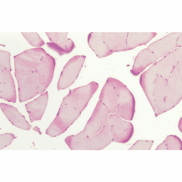 Immunohistochemistry - Anti-HSP27 Antibody (A305135) - Antibodies.com