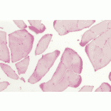 Immunohistochemistry - Anti-HSP27 Antibody (A305135) - Antibodies.com
