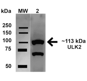 Western Blot - Anti-ULK2 Antibody (A305136) - Antibodies.com