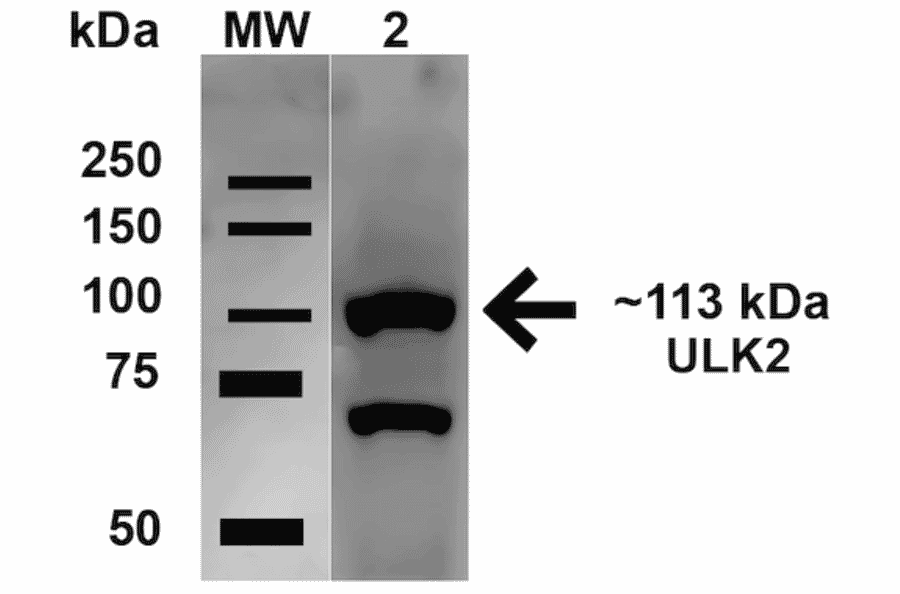 Western Blot - Anti-ULK2 Antibody (A305136) - Antibodies.com