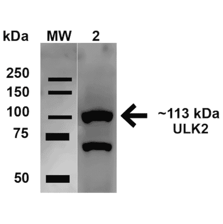 Western Blot - Anti-ULK2 Antibody (A305136) - Antibodies.com