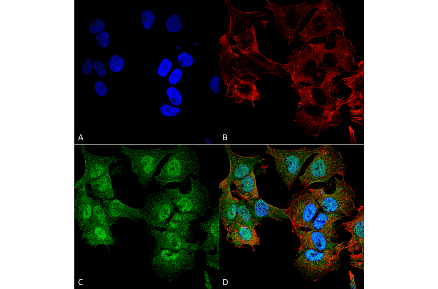Immunocytochemistry/Immunofluorescence - Anti-ULK2 Antibody (A305136) - Antibodies.com