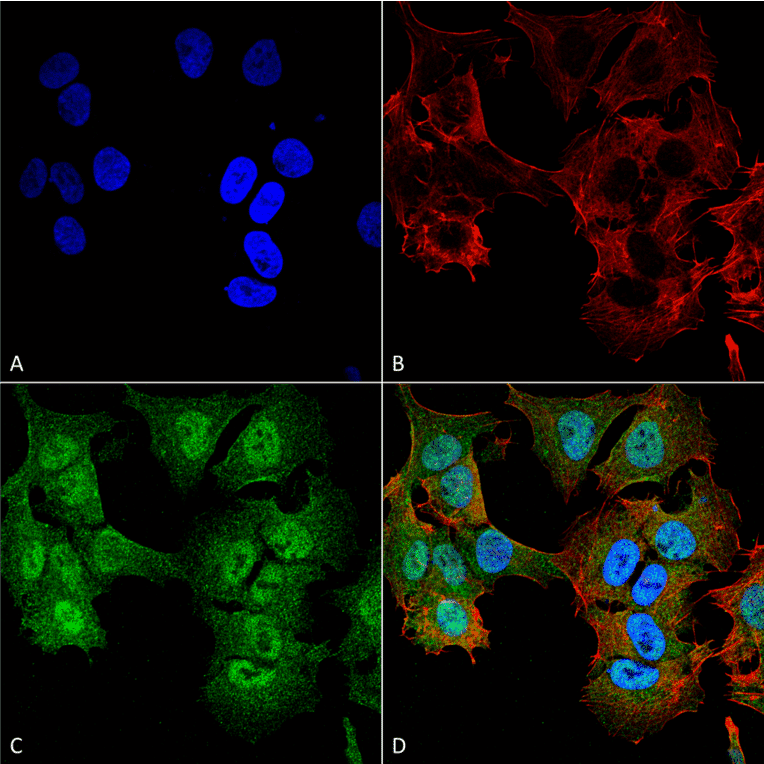 Immunocytochemistry/Immunofluorescence - Anti-ULK2 Antibody (A305136) - Antibodies.com