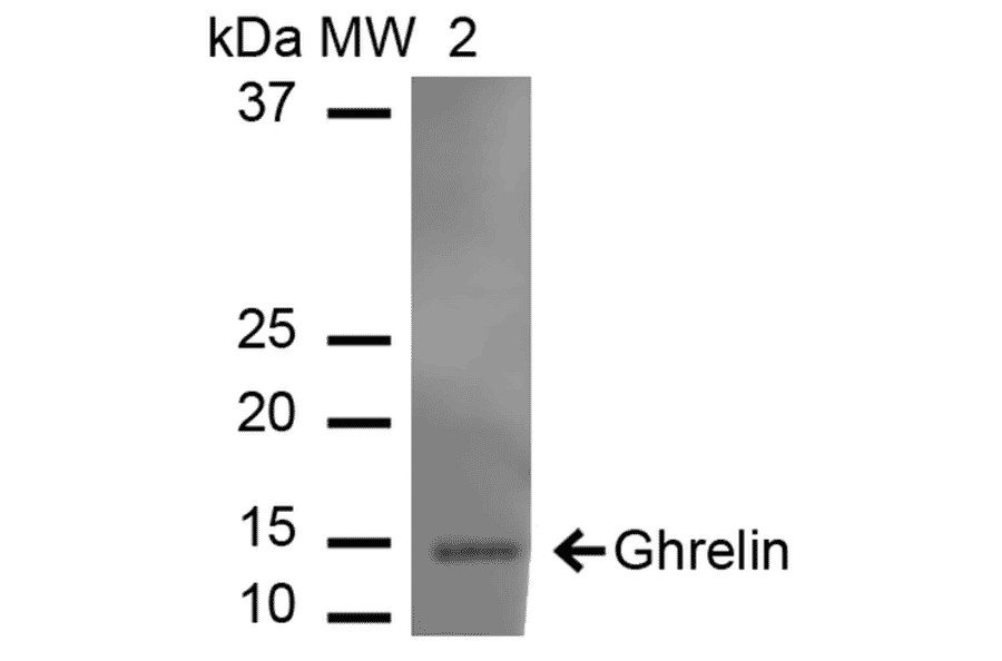 Western Blot - Anti-Ghrelin Antibody (A305137) - Antibodies.com
