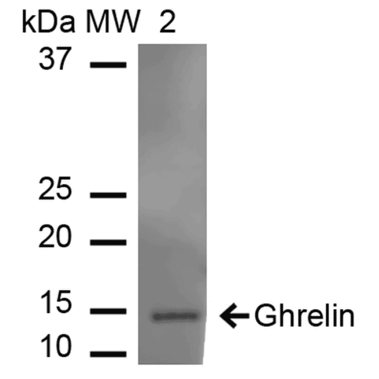 Western Blot - Anti-Ghrelin Antibody (A305137) - Antibodies.com