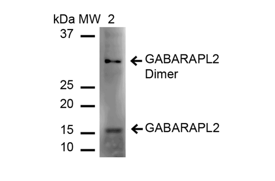 Western Blot - Anti-GABARAPL2 Antibody (A305138) - Antibodies.com