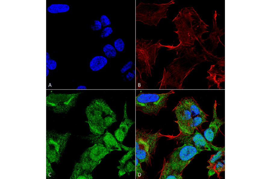 Immunocytochemistry/Immunofluorescence - Anti-GABARAPL2 Antibody (A305138) - Antibodies.com