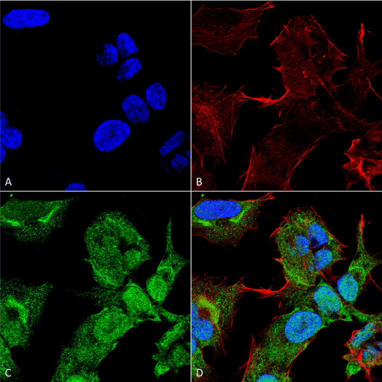 Immunocytochemistry/Immunofluorescence - Anti-GABARAPL2 Antibody (A305138) - Antibodies.com