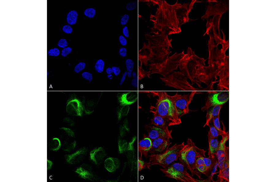 Immunocytochemistry/Immunofluorescence - Anti-AMBRA1 Antibody (A305140) - Antibodies.com
