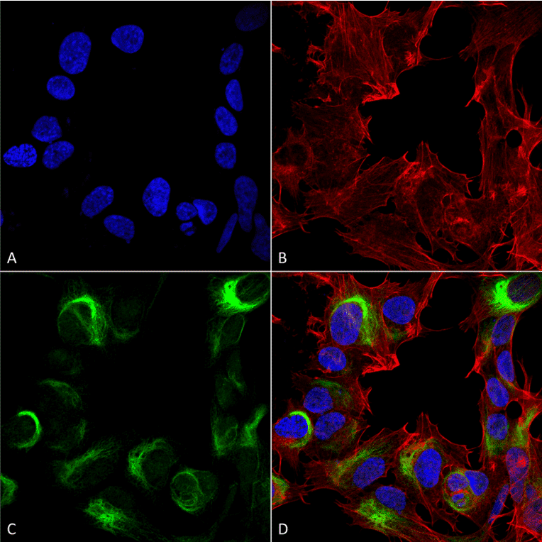 Immunocytochemistry/Immunofluorescence - Anti-AMBRA1 Antibody (A305140) - Antibodies.com