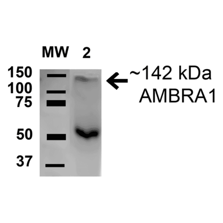 Western Blot - Anti-AMBRA1 Antibody (A305140) - Antibodies.com