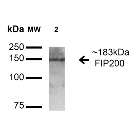 Western Blot - Anti-FIP200 Antibody (A305141) - Antibodies.com