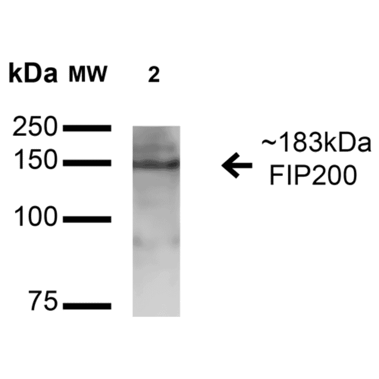 Western Blot - Anti-FIP200 Antibody (A305141) - Antibodies.com