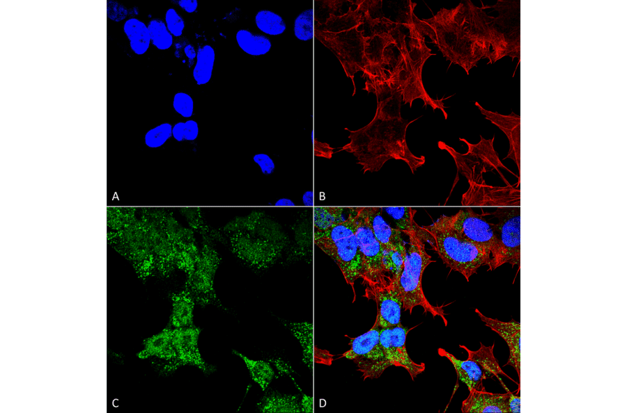 Immunocytochemistry/Immunofluorescence - Anti-FIP200 Antibody (A305141) - Antibodies.com
