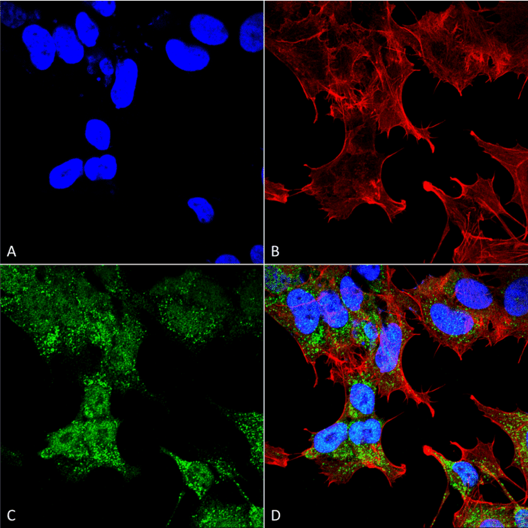Immunocytochemistry/Immunofluorescence - Anti-FIP200 Antibody (A305141) - Antibodies.com