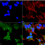 Immunocytochemistry/Immunofluorescence - Anti-FIP200 Antibody (A305141) - Antibodies.com