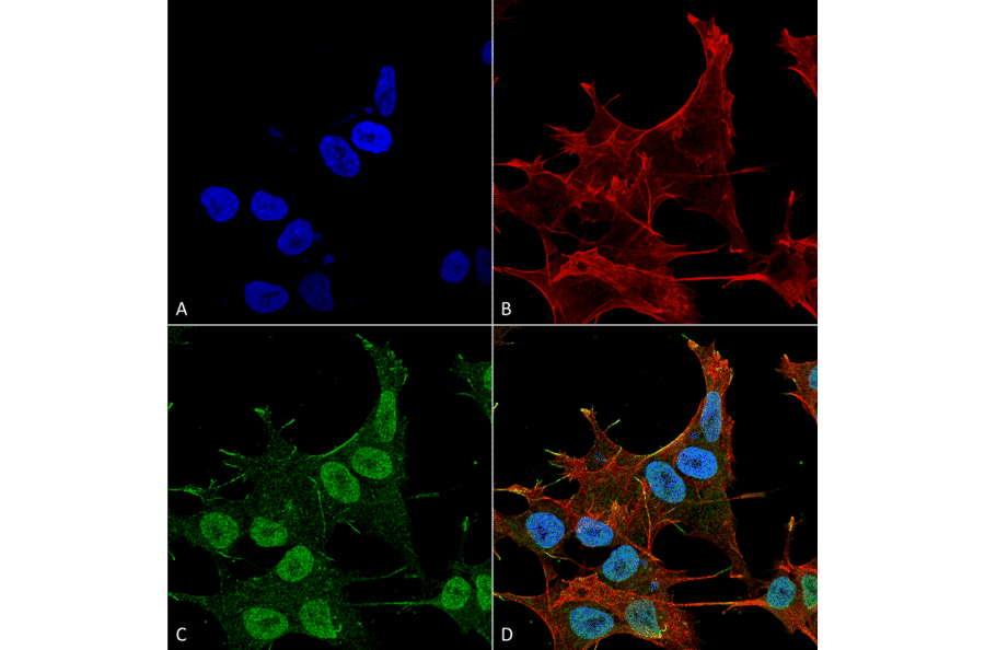 Immunocytochemistry/Immunofluorescence - Anti-VPS15 Antibody (A305142) - Antibodies.com