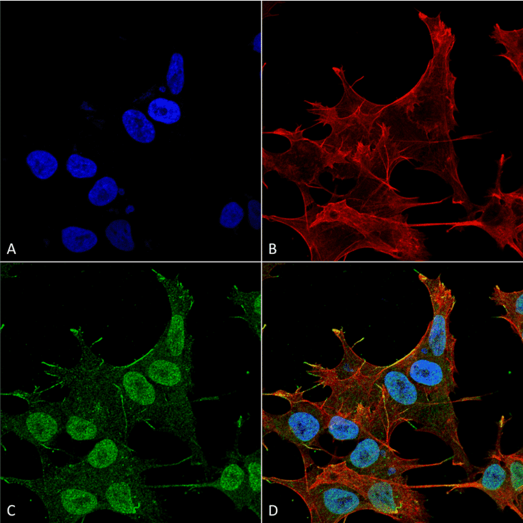 Immunocytochemistry/Immunofluorescence - Anti-VPS15 Antibody (A305142) - Antibodies.com