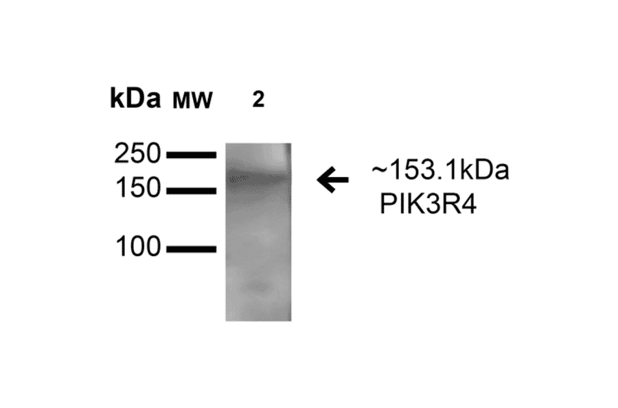 Western Blot - Anti-VPS15 Antibody (A305142) - Antibodies.com