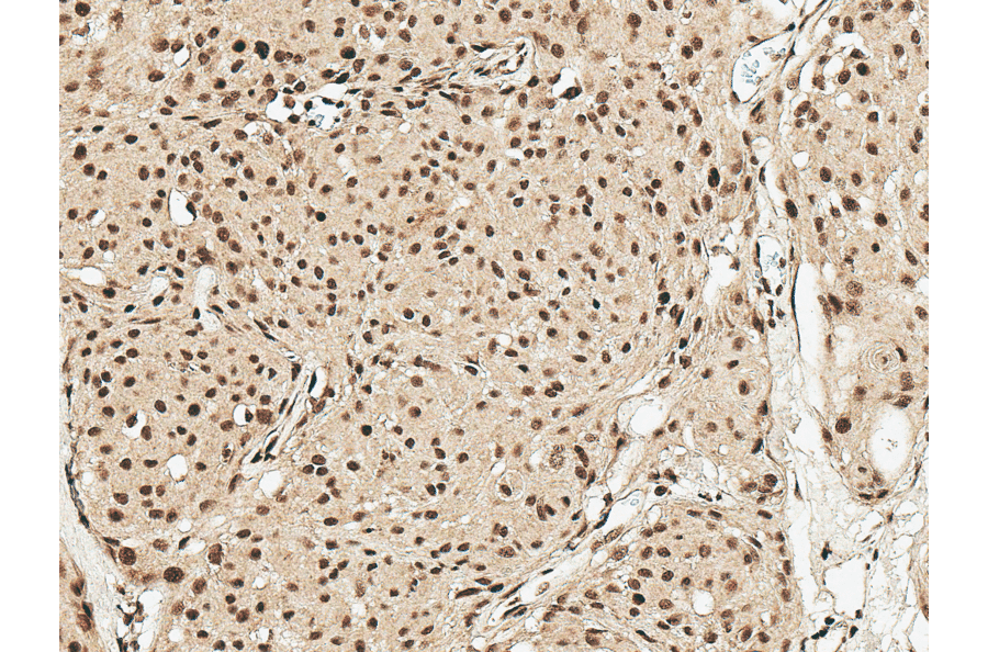 Immunohistochemistry - Anti-GDNF Antibody (A305143) - Antibodies.com