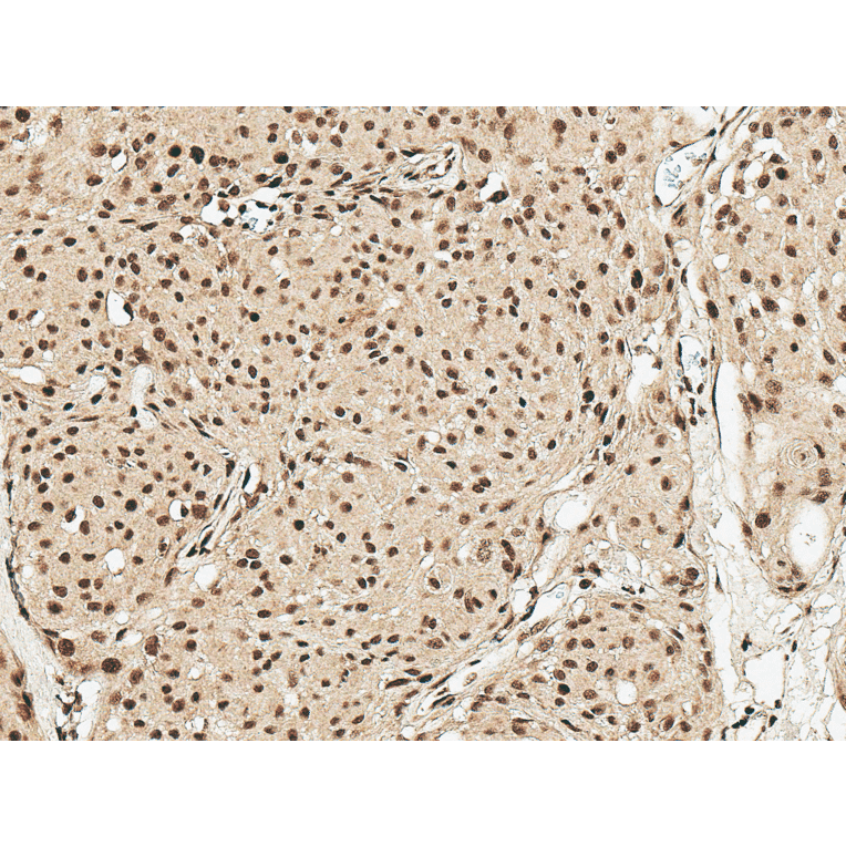 Immunohistochemistry - Anti-GDNF Antibody (A305143) - Antibodies.com