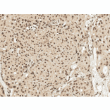 Immunohistochemistry - Anti-GDNF Antibody (A305143) - Antibodies.com