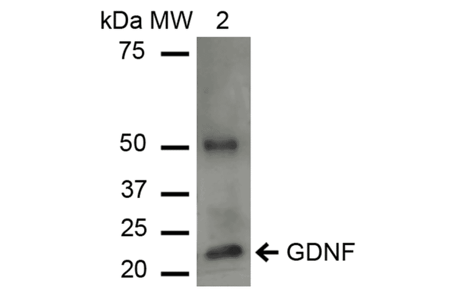 Western Blot - Anti-GDNF Antibody (A305143) - Antibodies.com