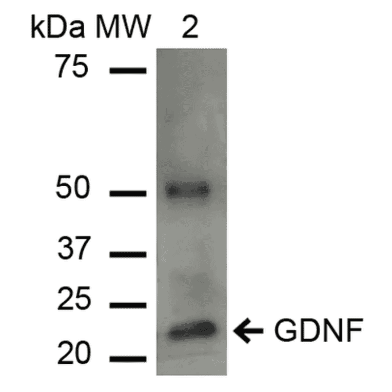 Western Blot - Anti-GDNF Antibody (A305143) - Antibodies.com