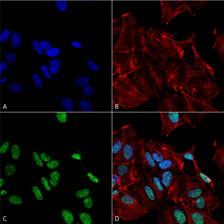 Immunocytochemistry/Immunofluorescence - Anti-GDNF Antibody (A305143) - Antibodies.com