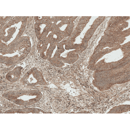 Immunohistochemistry - Anti-Bcl-2 Antibody (A305144) - Antibodies.com